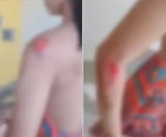 Jovem se joga de moto em movimento após se assustar com mudança de rota em Maceió Uma jovem de 19 anos ficou ferida após saltar de uma motocicleta durante uma corrida por aplicativo, entre os bairros Santos Dumont e Eustáquio Gomes, na par