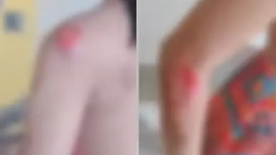 Jovem se joga de moto em movimento após se assustar com mudança de rota em Maceió  Uma jovem de 19 anos ficou ferida após saltar de uma motocicleta durante uma corrida por aplicativo, entre os bairros Santos Dumont e Eustáquio Gomes, na par